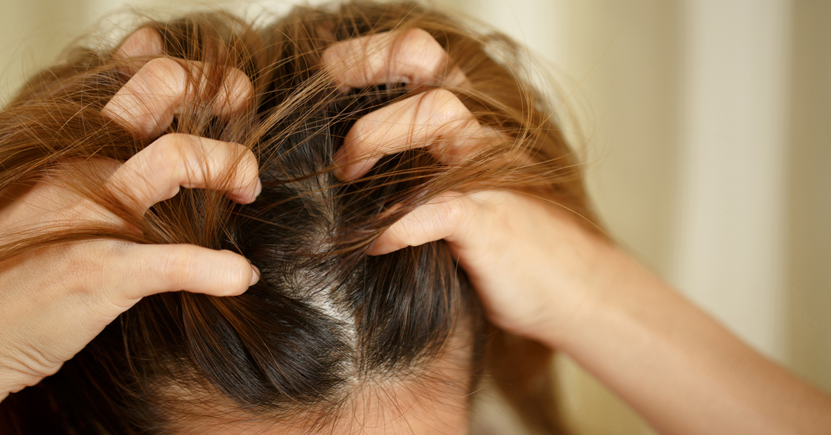 Mikä on trikotillomania – tila, joka johtaa hiusten repimiseen ja vaikuttaa mielenterveyteen?