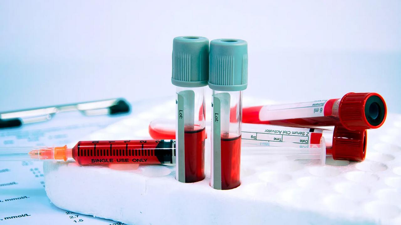 Yksinkertainen verikoe mahdollistaa sairauden ennustamisen 10 vuotta ennen ensimmäisten oireiden ilmaantumista