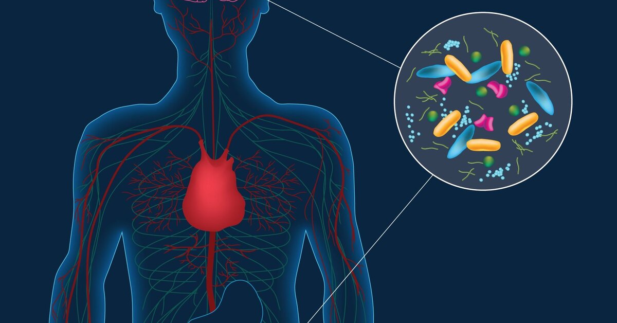 Parkinsonin taudin yhteys suolistobakteereihin tarjoaa yllättävän yksinkertaisen hoitomuodon