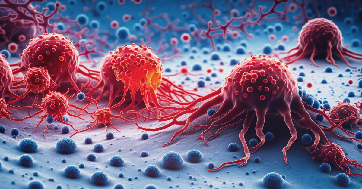 Suomessa hylätty syövän hoitomenetelmä on menestynyt ulkomailla