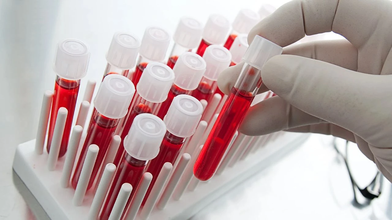 Yksinkertainen verikoe mahdollistaa sairauden ennustamisen 10 vuotta ennen ensimmäisten oireiden ilmaantumista