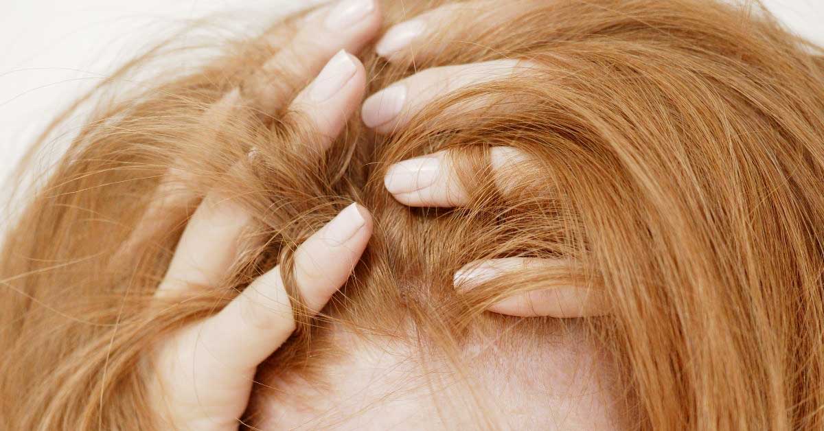 Mikä on trikotillomania – tila, joka johtaa hiusten repimiseen ja vaikuttaa mielenterveyteen?