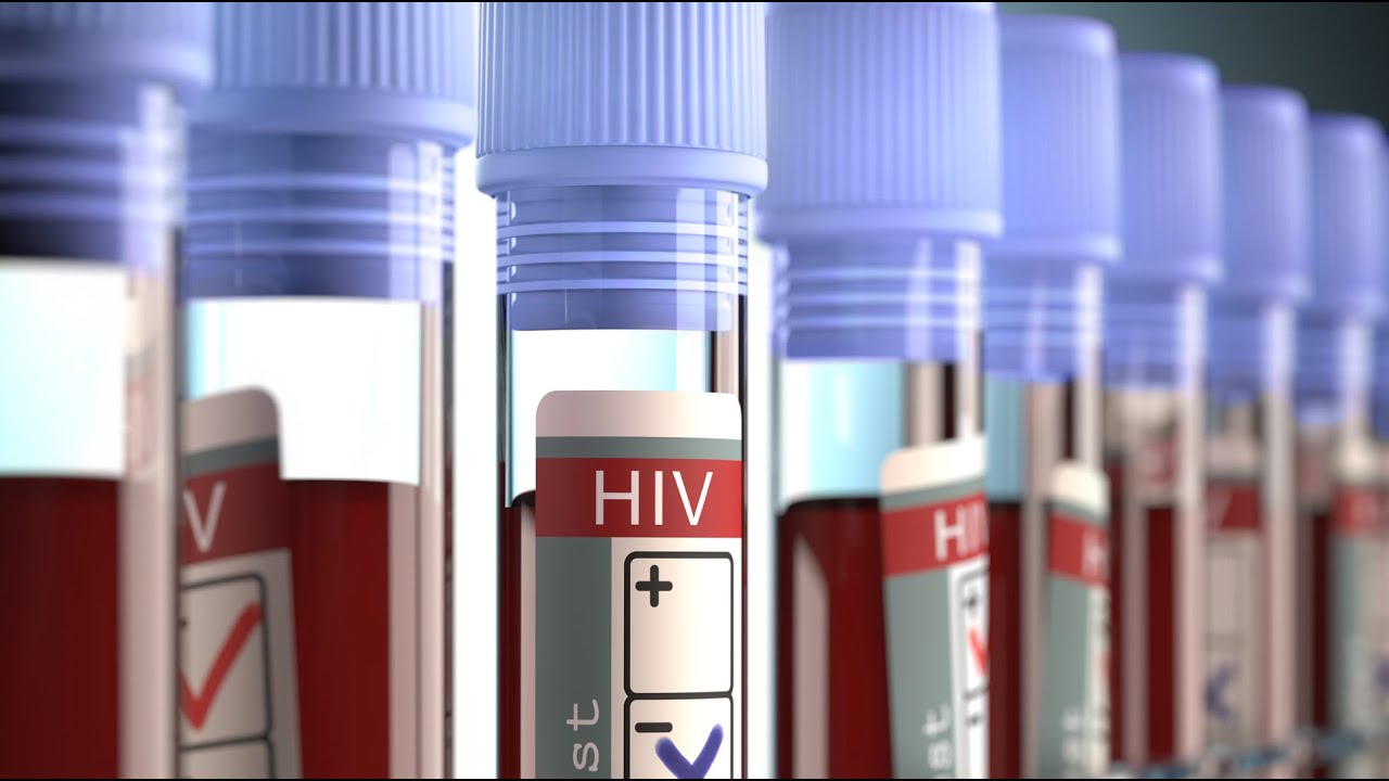 Suomessa on lähes 1000 tartunnan saanutta, joista monet eivät vielä tiedä tartunnastaan