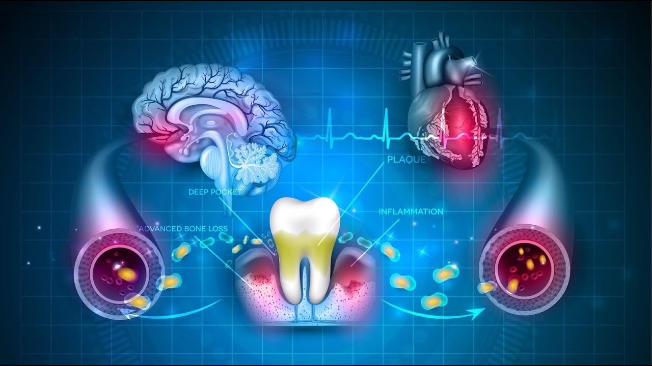 Lisää sydänkohtauksen riskiä