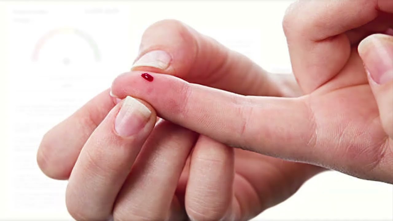 Yksinkertainen verikoe mahdollistaa sairauden ennustamisen 10 vuotta ennen ensimmäisten oireiden ilmaantumista