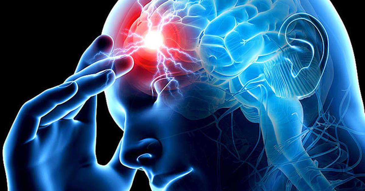 Onko hiustenpesun jälkeen riski saada aivohalvaus?