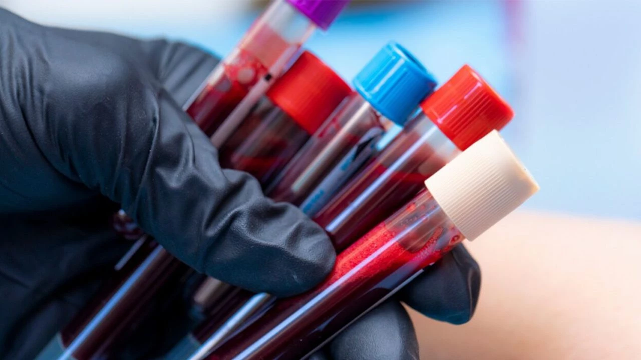 Uusi tutkimus osoittaa, että yksi veriryhmä liittyy vakavaan maksasairauteen