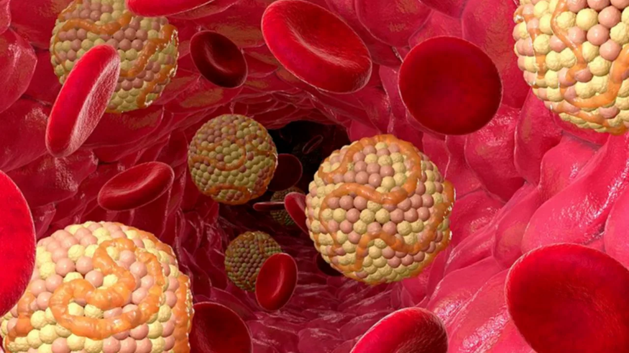 Kolesteroli: sen pitoisuutta nostavat tavat ja vältettävät asiat