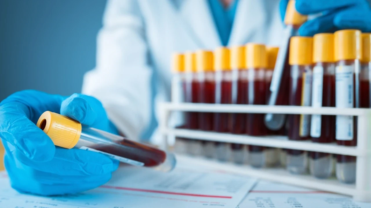 Uusi tutkimus osoittaa, että yksi veriryhmä liittyy vakavaan maksasairauteen