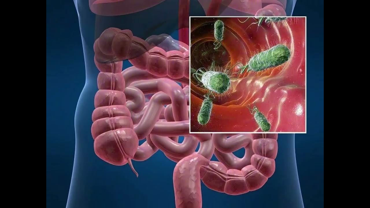 ”Fekaalivirus” on saamassa uutta vauhtia: uusi merkittävä huippu poikkeuksellisen vuoden 2024 jälkeen.